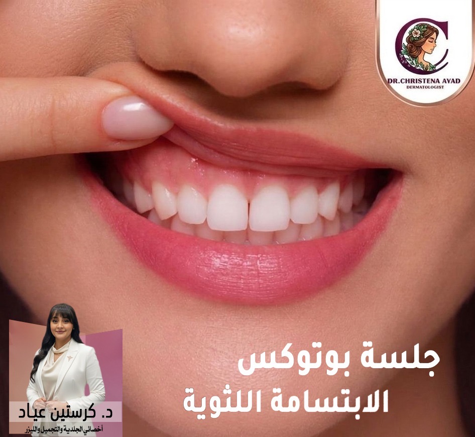 الابتسامة اللثوية