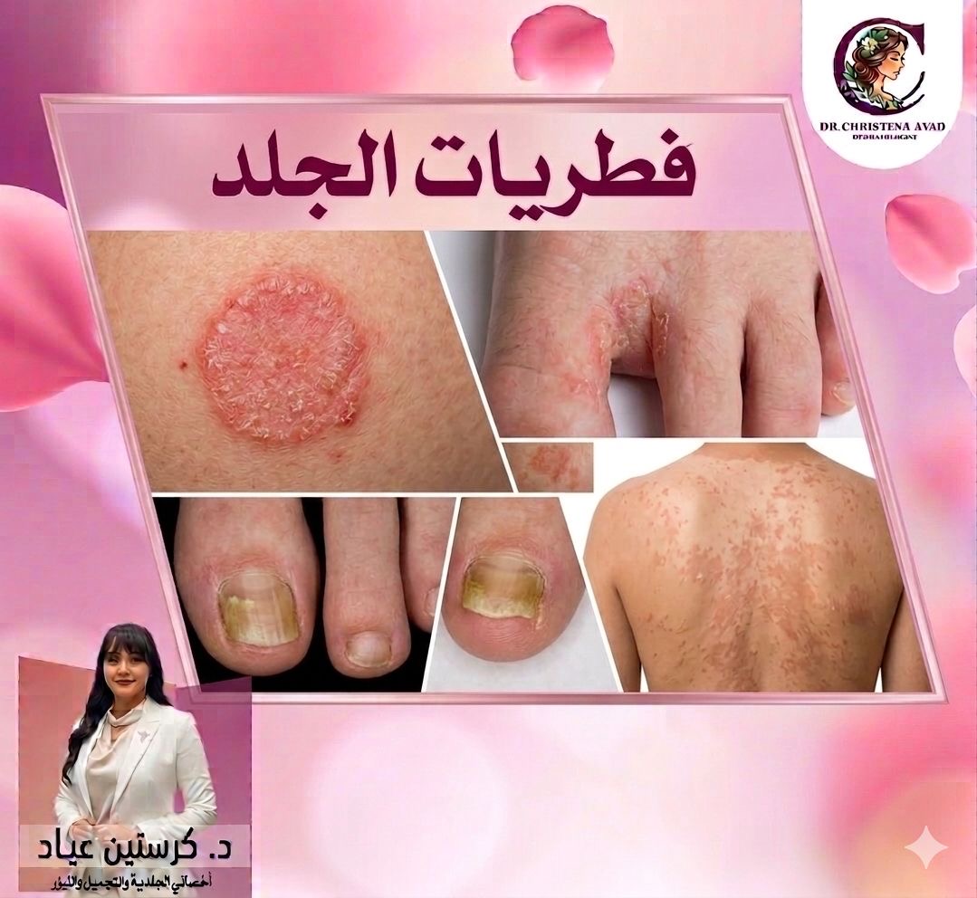 Skin Fungal Treatment